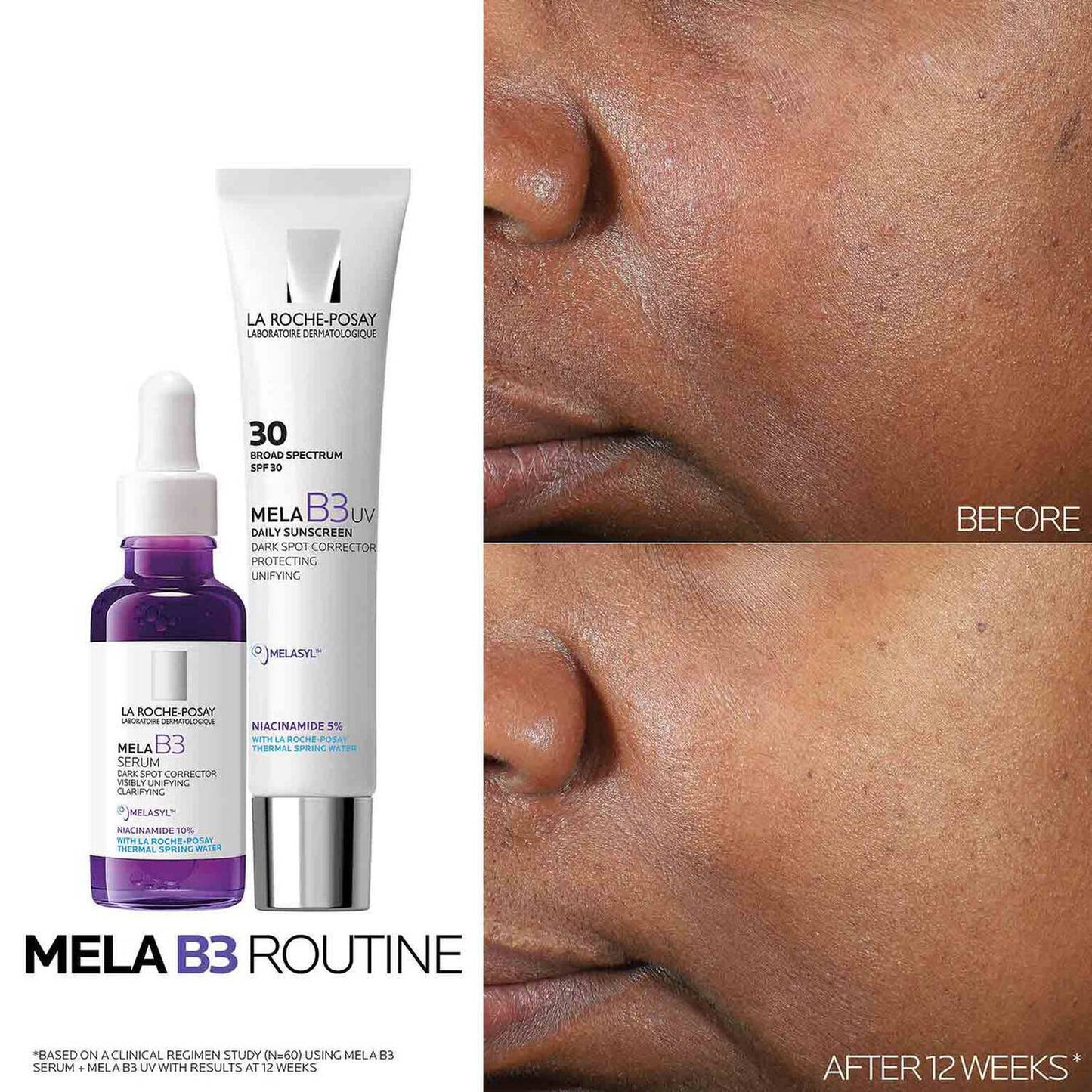 mela-b3-dark-spot-serum-and-mela-b3-uv-daily-moisturizer-with-spf-30-c2 3-Mela-B3-routine_1500X1500.jpg