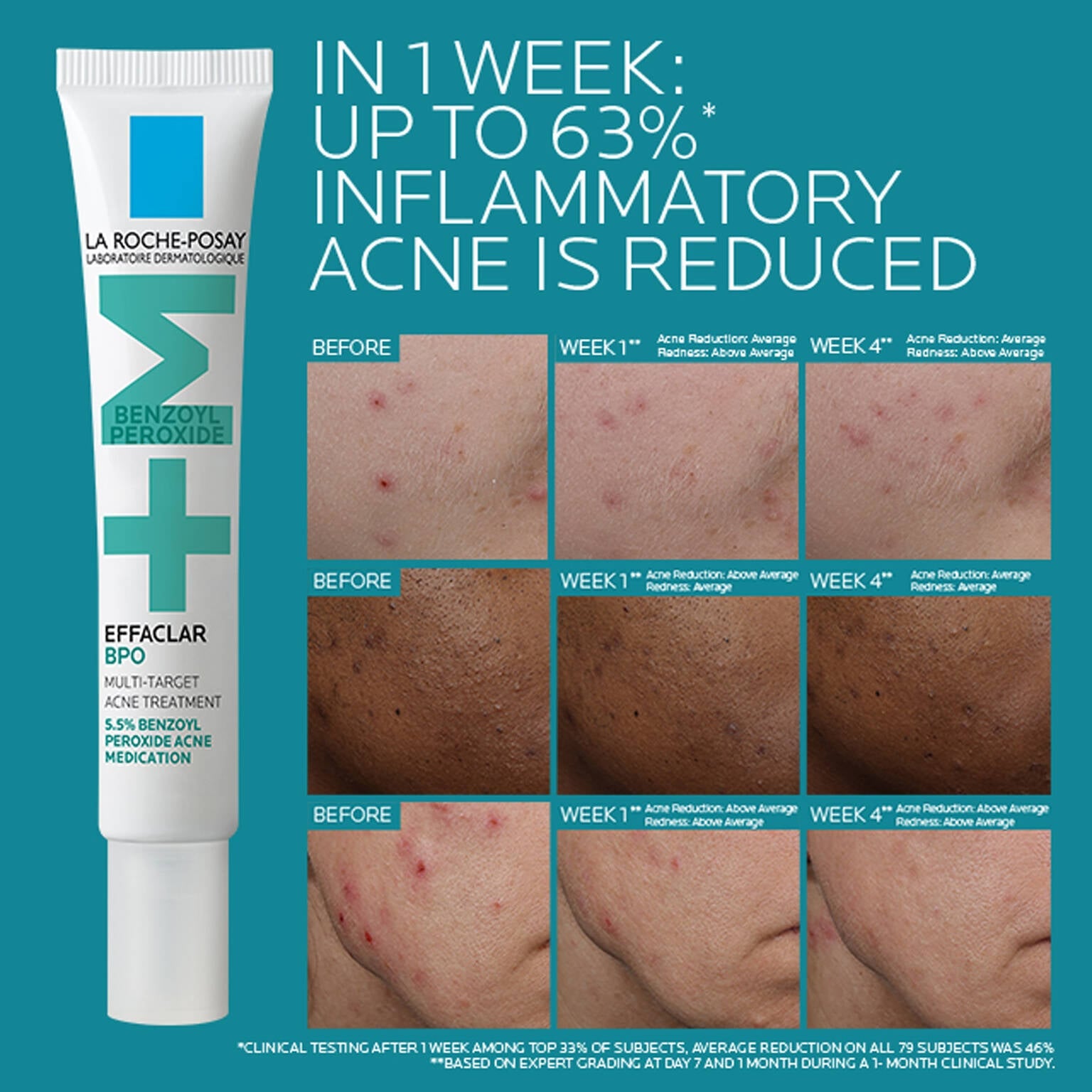 effaclar-bpo-multi-target-acne-treatment-with-5-5-benzoyl-peroxide-s8 EffaclarBPO-ClinicalBA-ATF-1500x1500-2.jpg