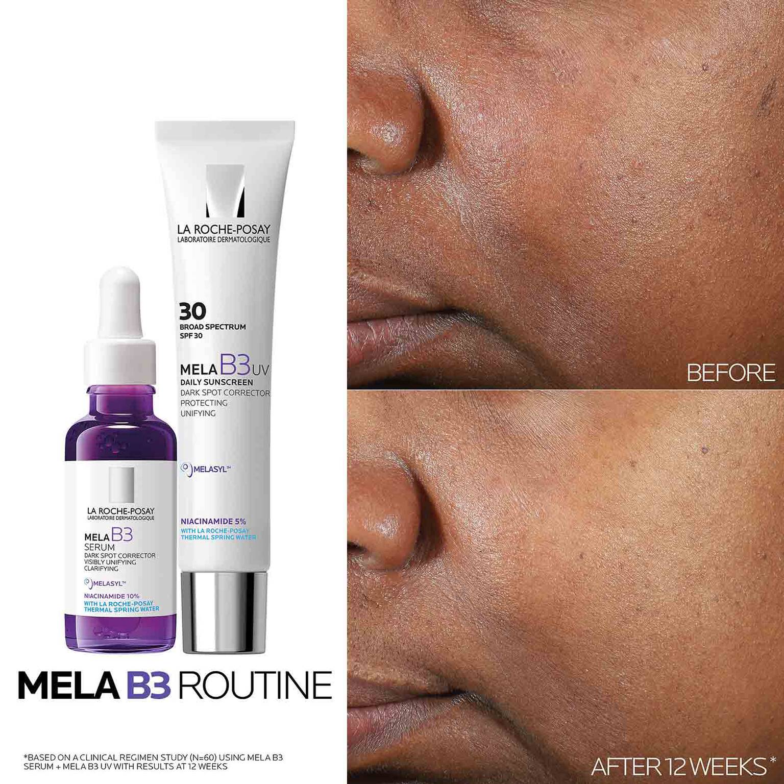 mela-b3-dark-spot-serum-with-melasyltm-niacinamide-b1 Mela-B3-routine_1500X1500.jpg
